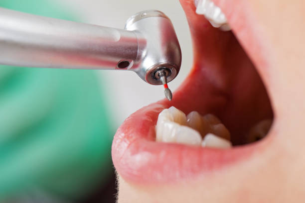 Best Emergency Treatment for Oral Infections in West Whittier Los Nietos, CA